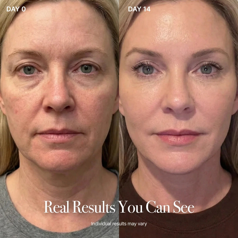 4-in-1 Lymphatic Renewal Facial Brush for Contour, Lift & Glow