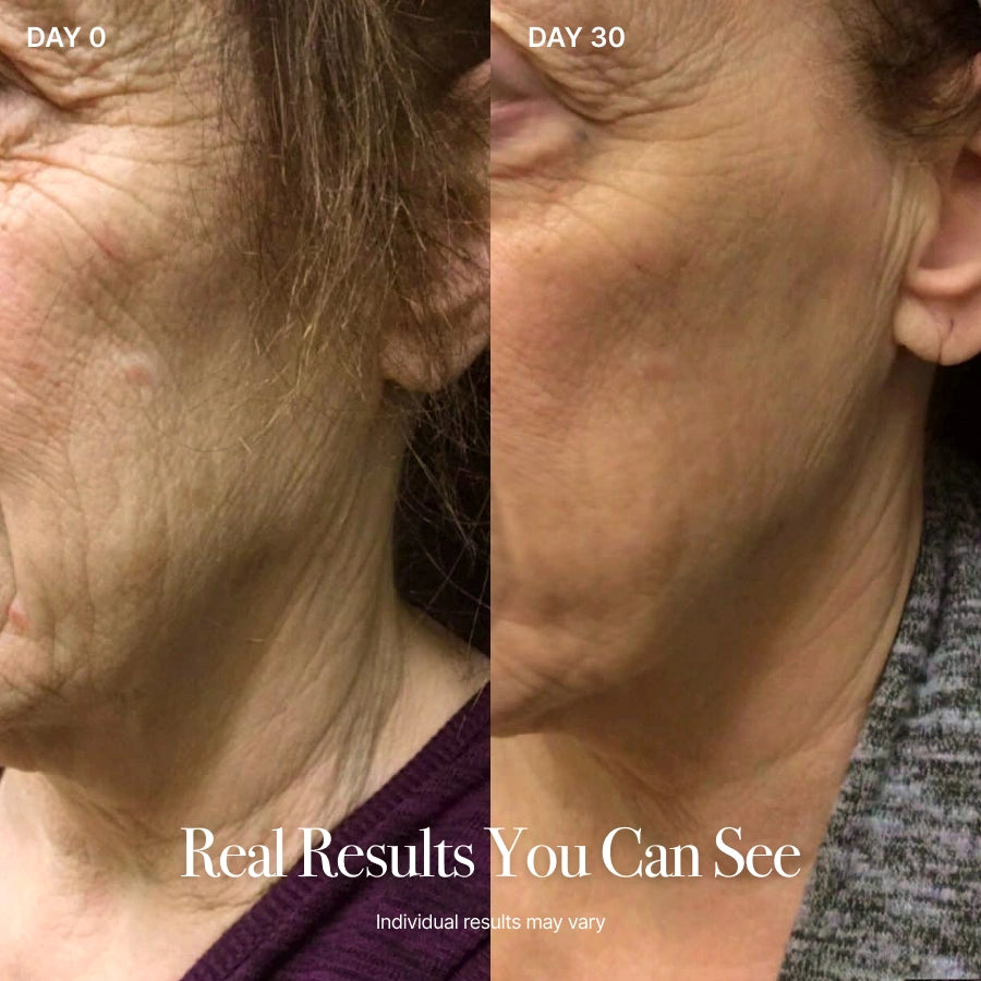 4-in-1 Lymphatic Renewal Facial Brush for Contour, Lift & Glow